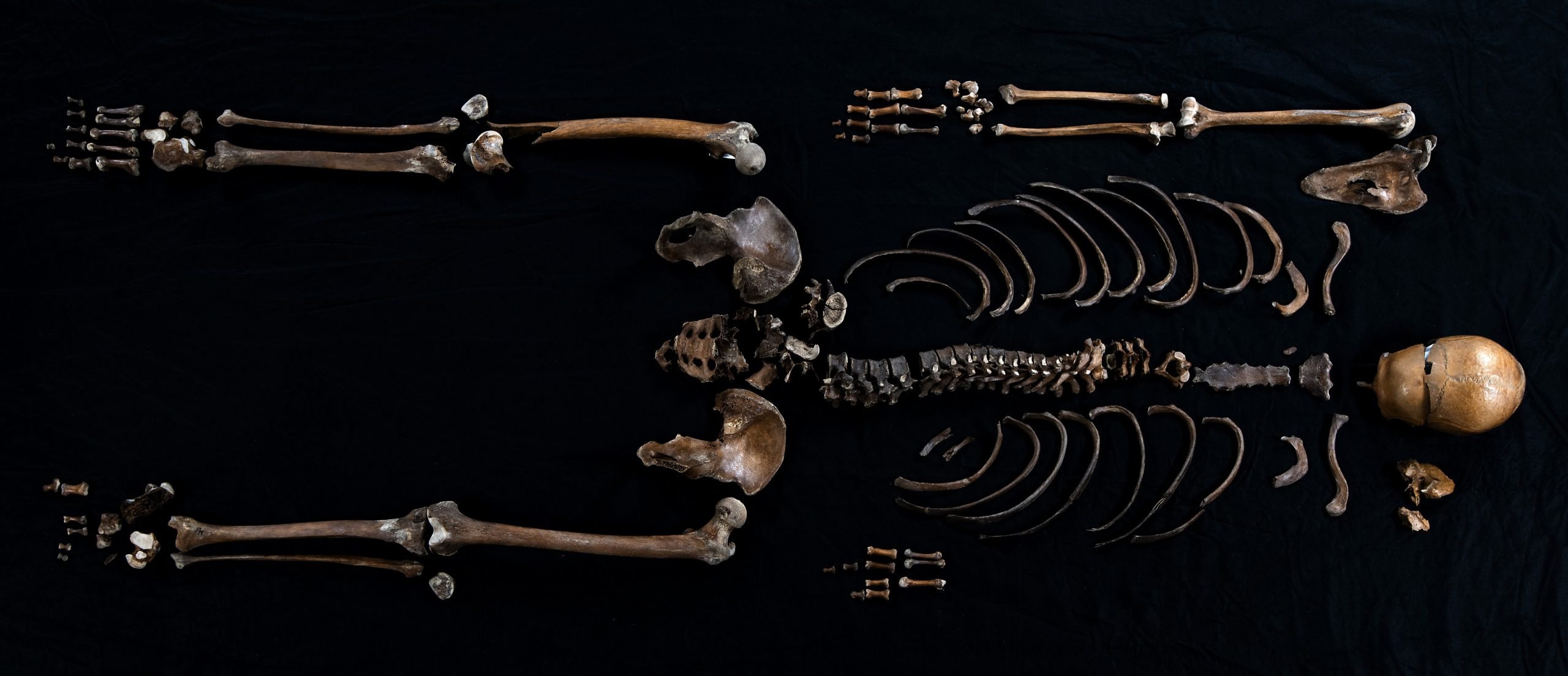 Well-Man-Skeleton-scaled.jpg