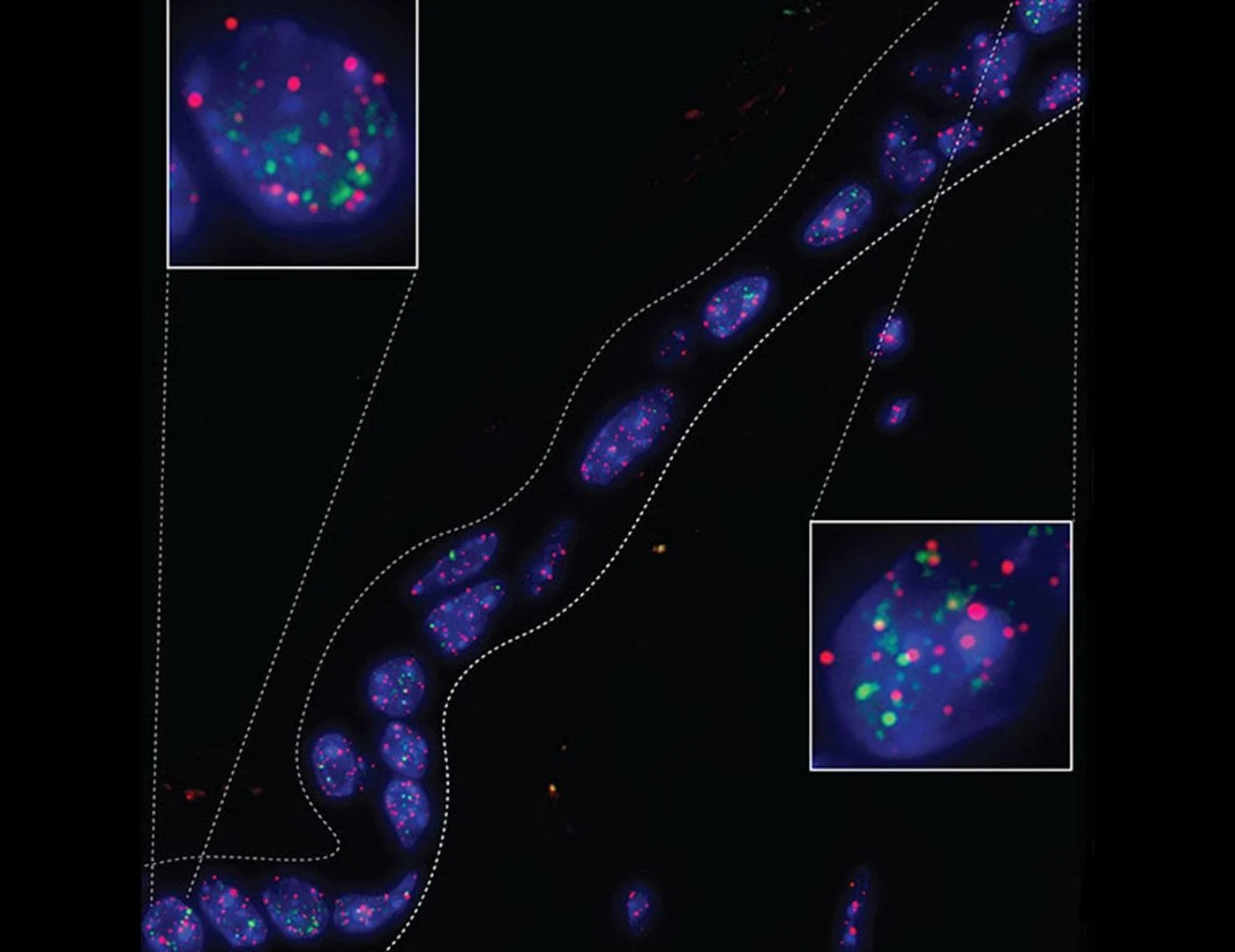 DNA-Damage-Within-Telomeres.jpg