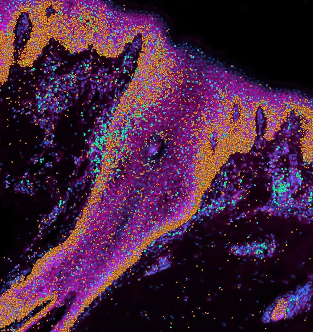 Human-Skin-Xenium-Zoomed-In.jpg