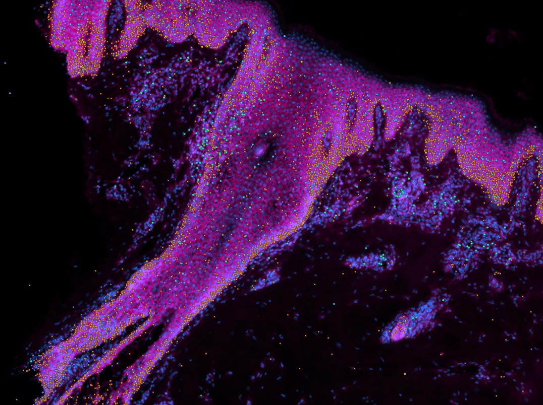 Xenium-of-Human-Skin-Zoomed-In.jpg