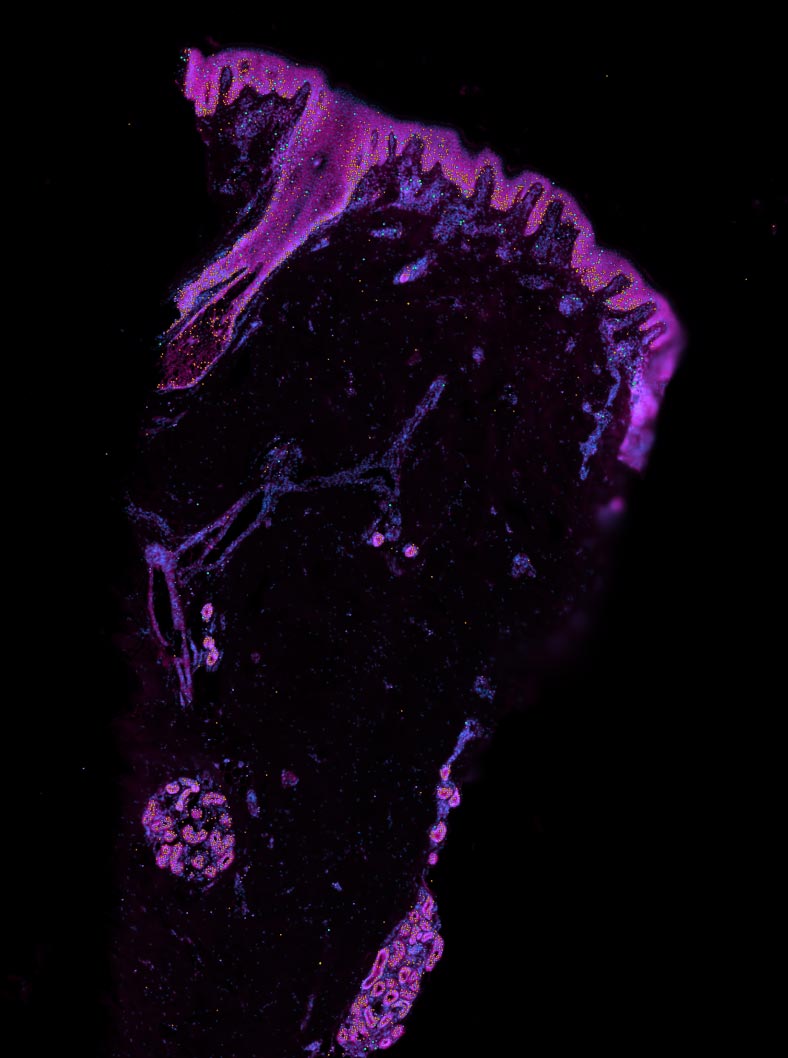 Xenium-of-Human-Skin.jpg