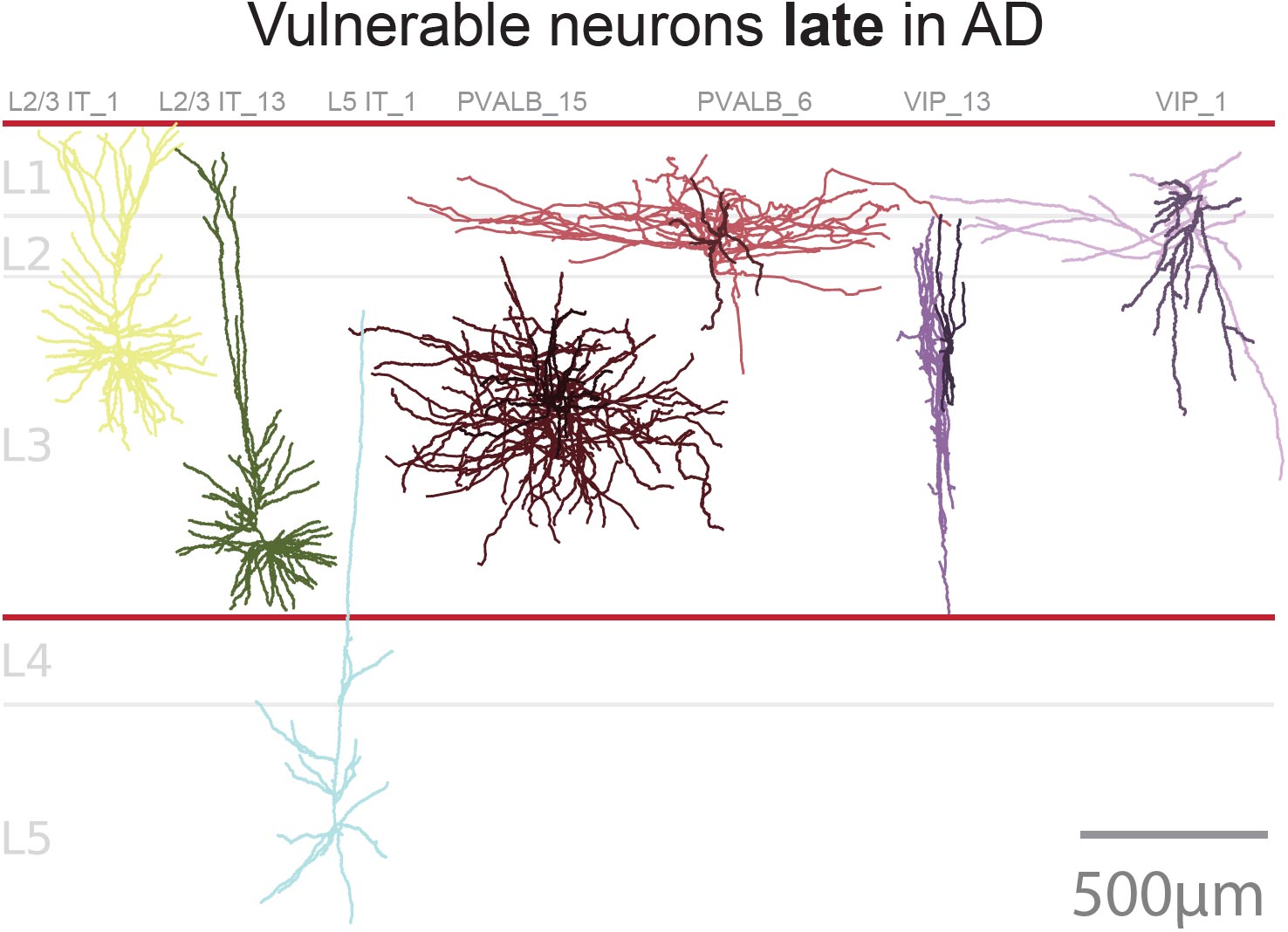 Vulnerable-Neurons-Later-in-AD.jpg