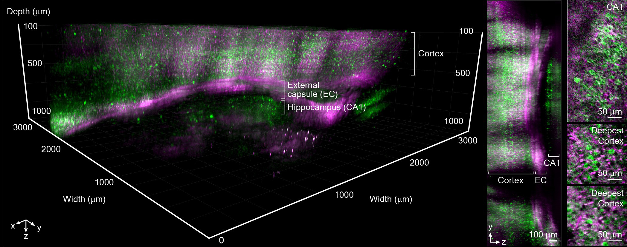 Deep-and-Large-Field-of-View-In-Vivo-Imaging-of-Mouse-Brain-Structures.jpg