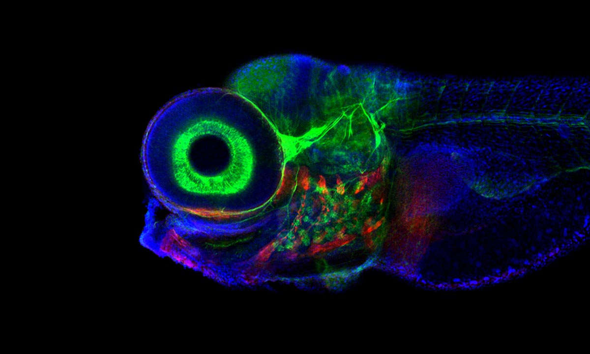 Zebrafish-Confocal-Microscope-Brain-Eye-Movement.jpg