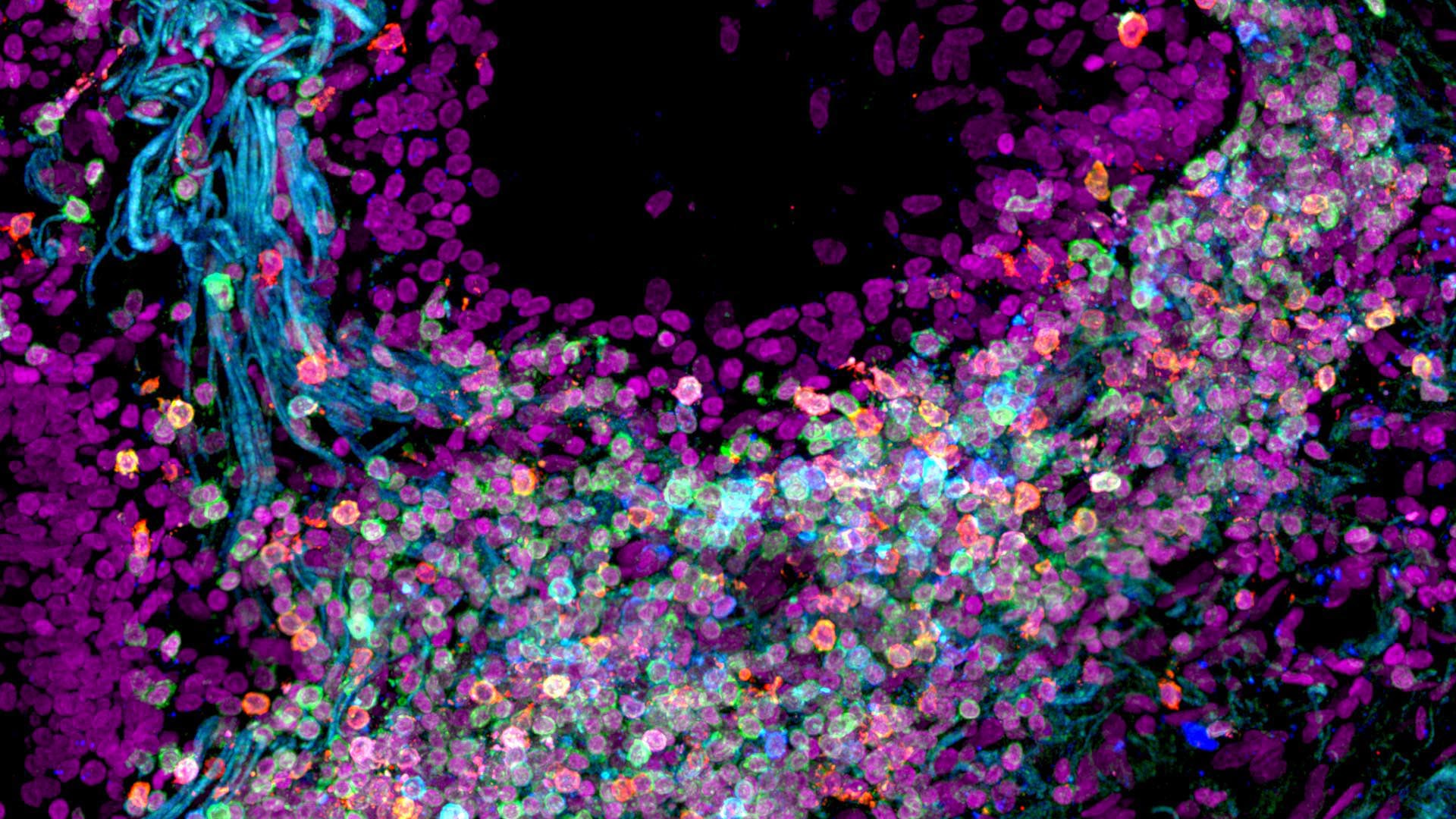 Human-Lung-Tissue.jpg