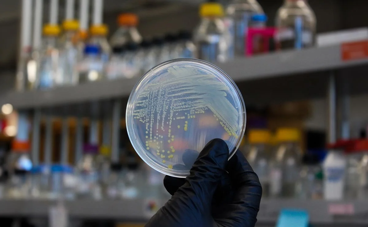 Petri-Plate-With-Bacterial-Colonies.webp