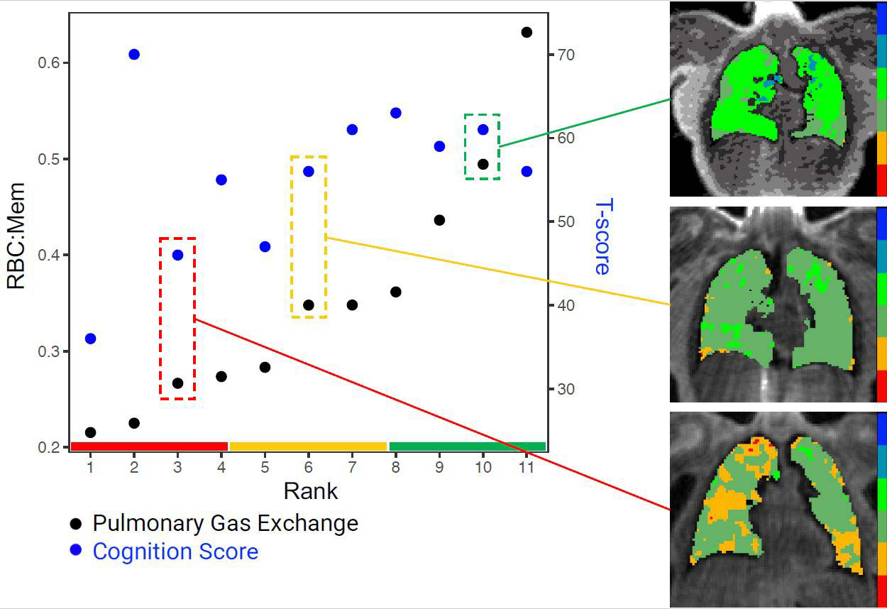 Long-COVID-Brain-Fog-Lung-Function-Graphic.jpg