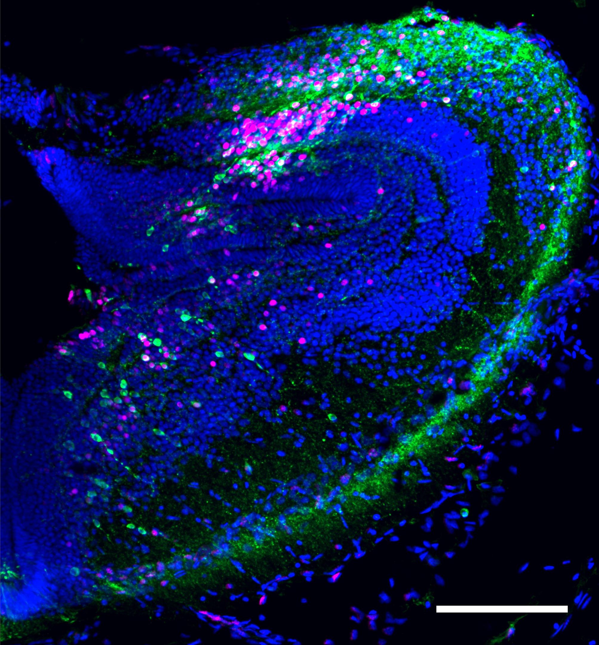 Coronal-Section-of-the-Frog-Midbrain.jpg