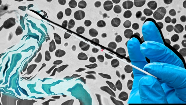 fischbach-vaccination.jpeg
