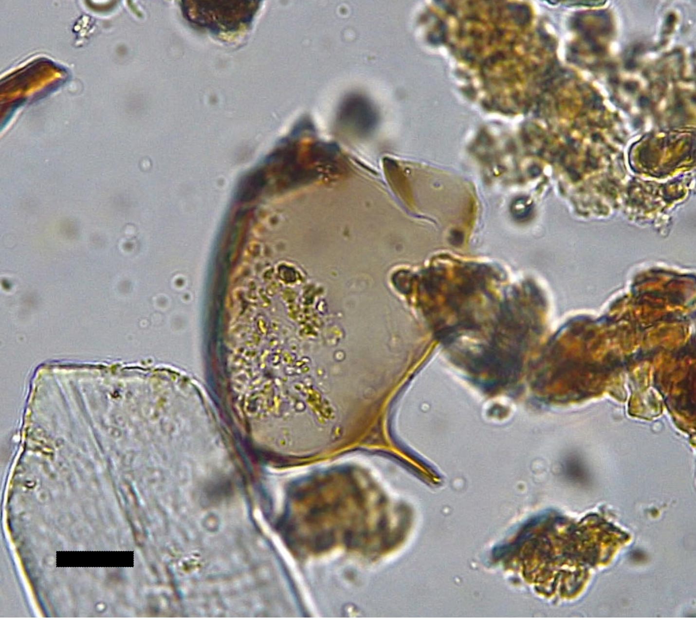 Schistosoma-mansoni-Egg.jpg