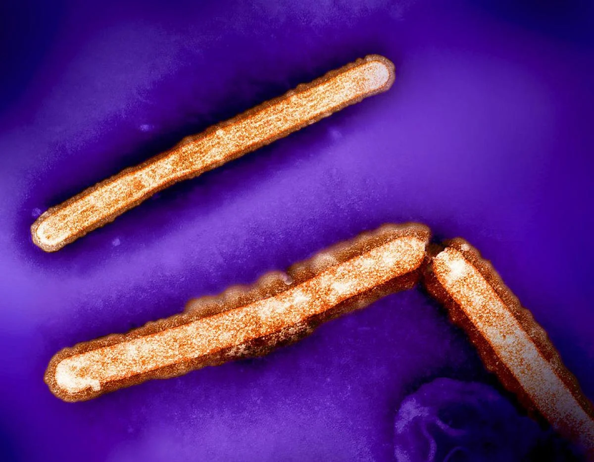 H5N1-Avian-Influenza-Particles.jpg