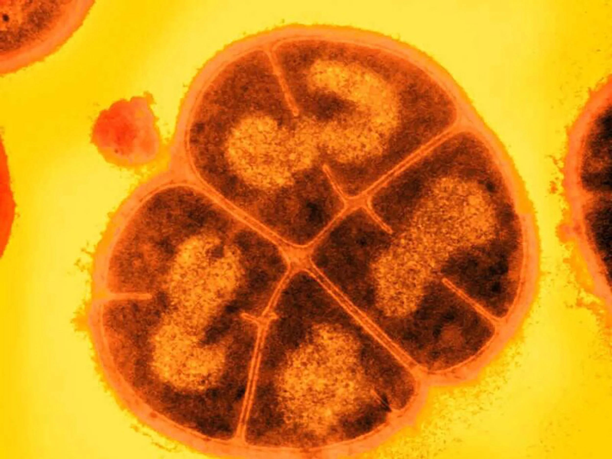 Conan-the-Bacterium-Deinococcus-radiodurans.jpg