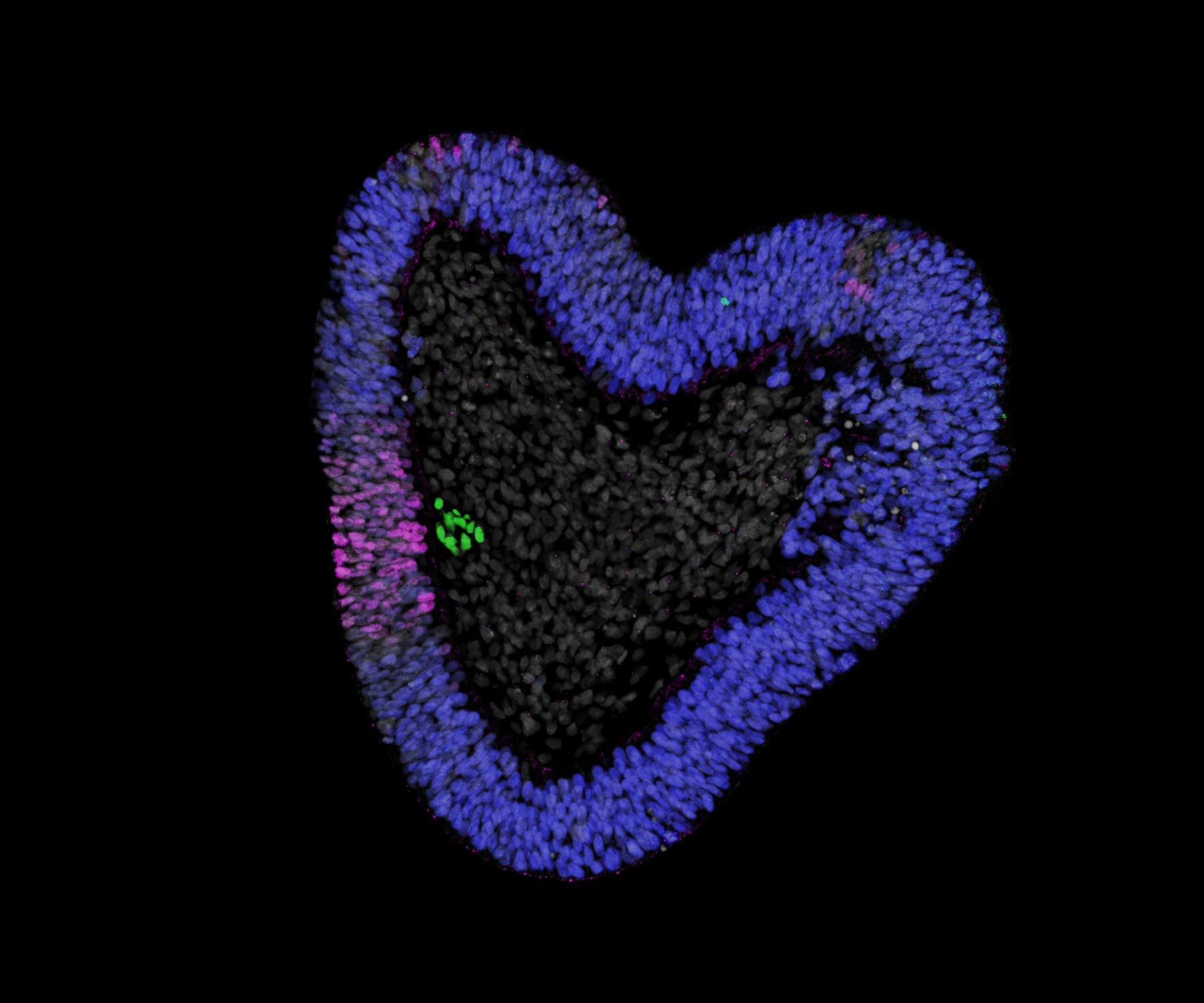 Section-of-Human-Trunk-Organoid.jpg