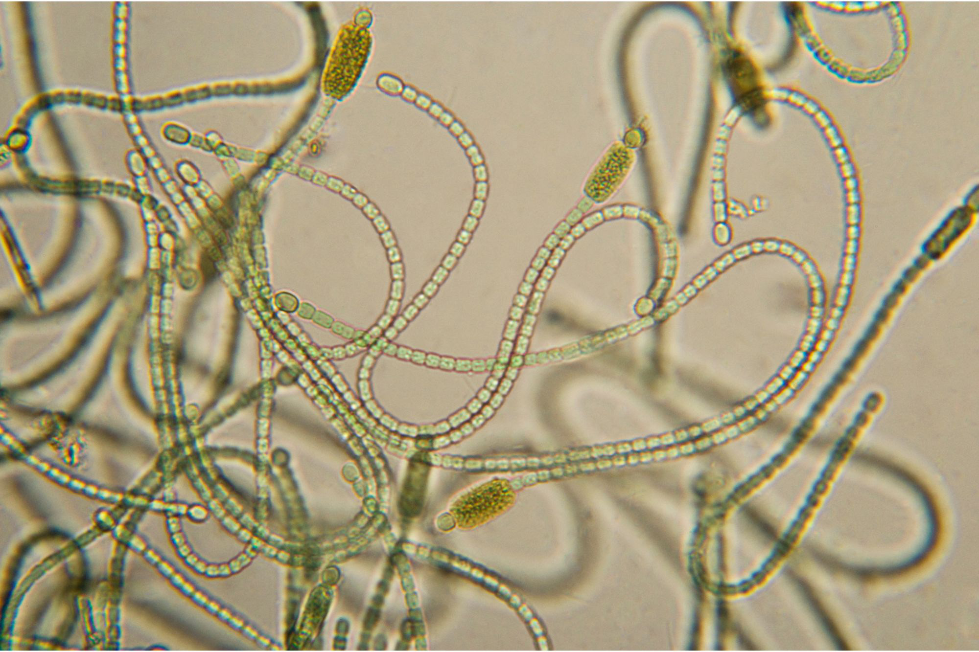 Cyanobacteria-1.jpg