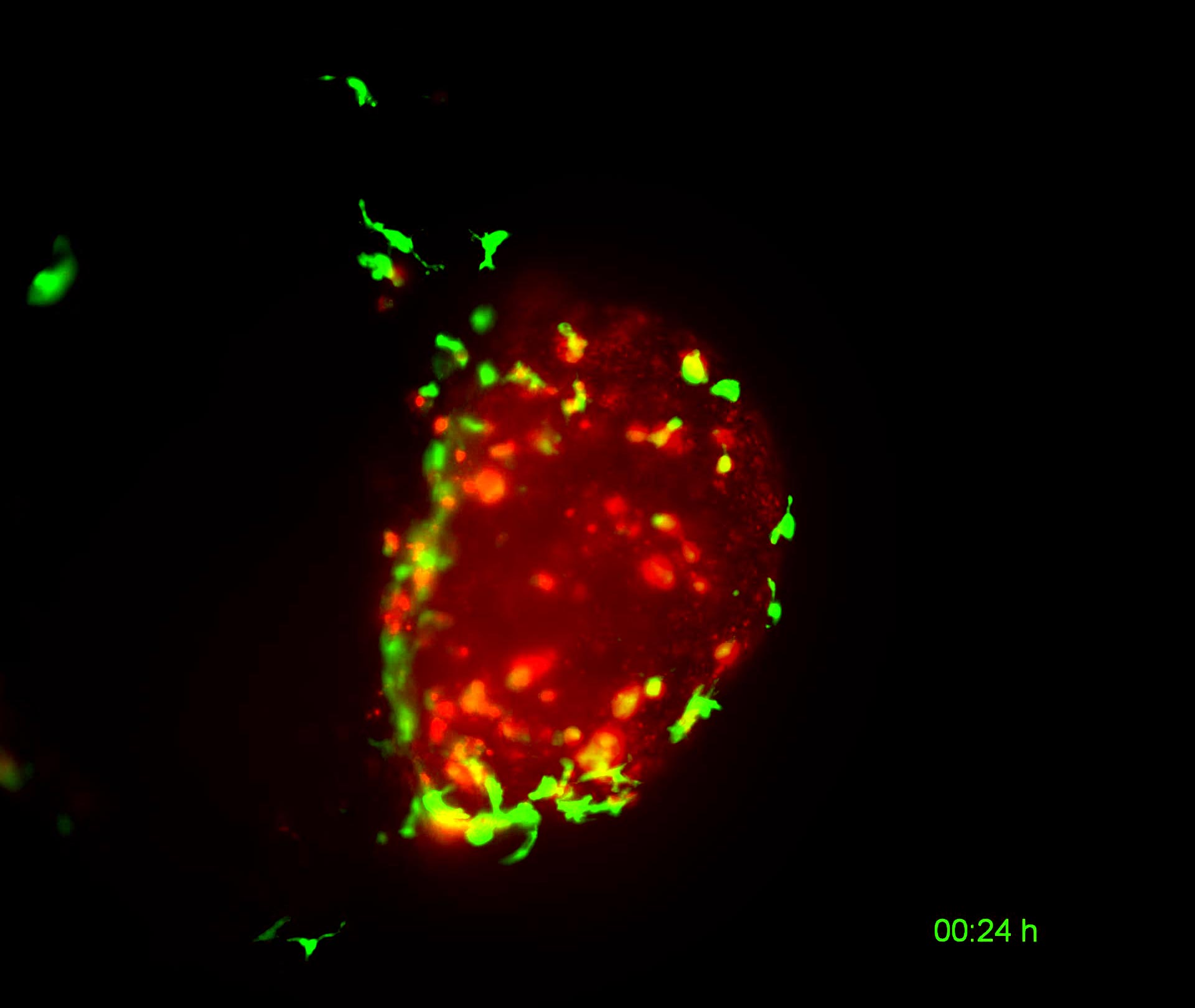 Human-Bladder-Tumour-Cleared-Zebrafish-Macrophages.jpg