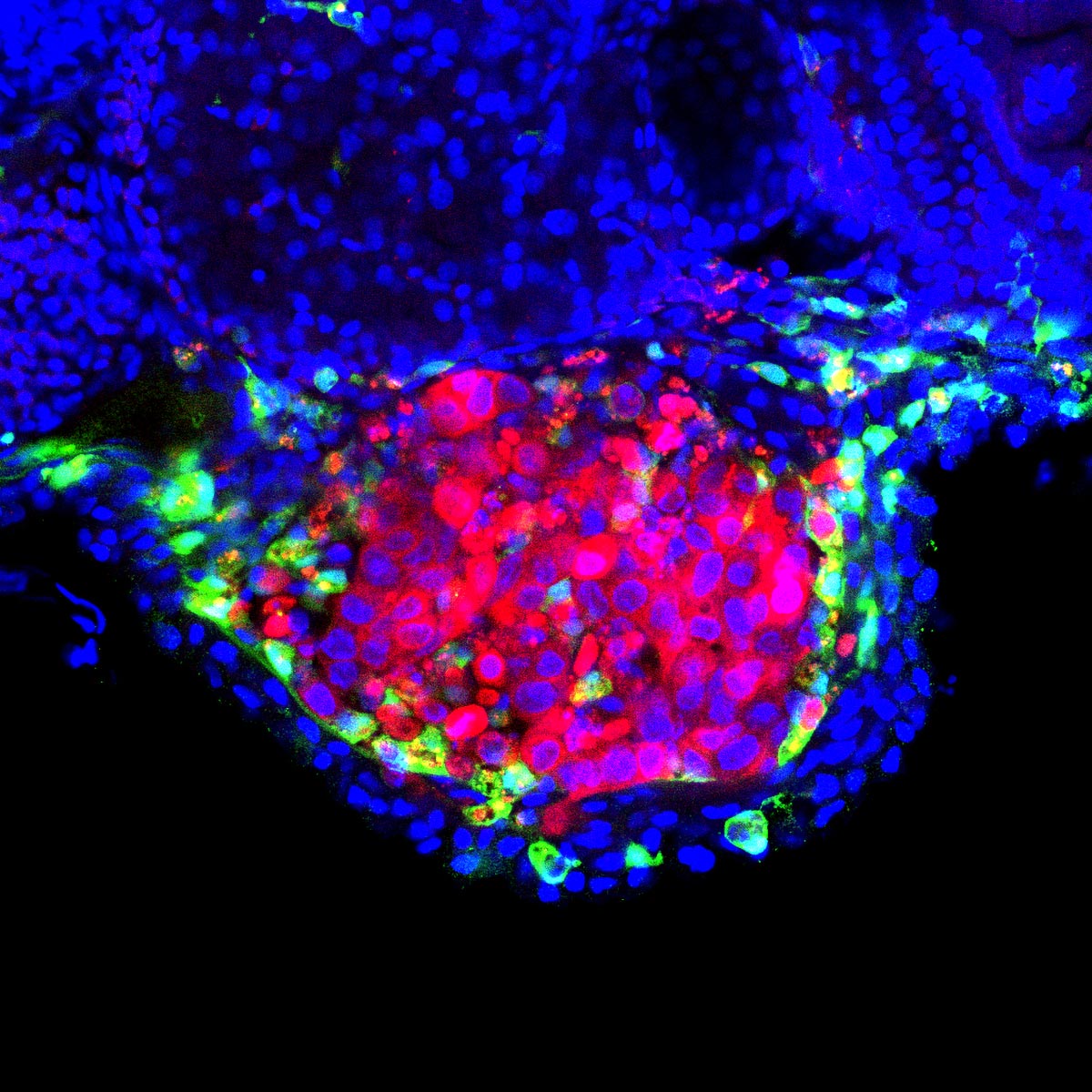 Human-Bladder-Tumor-Surrounded-by-Zebrafish-Macrophages.jpg