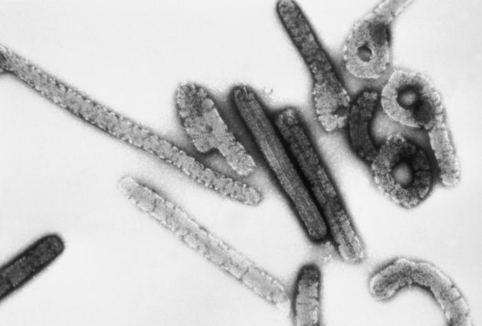 Marburg_virus.jpg