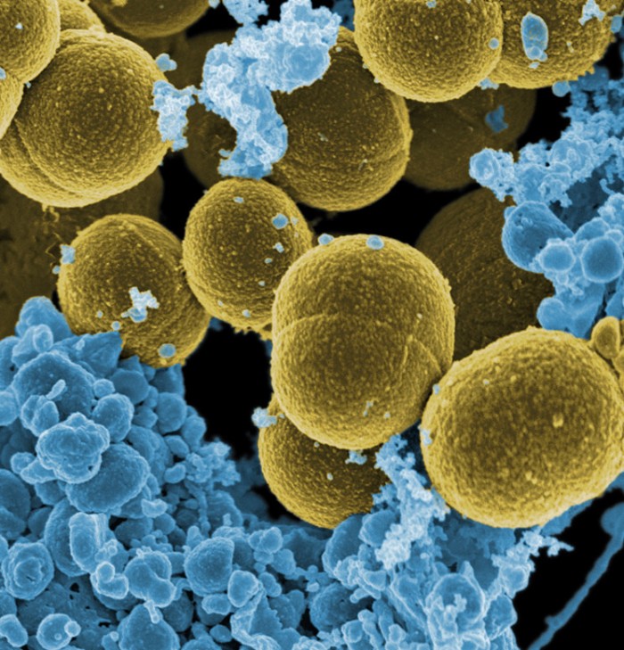 Staphylococcus_aureus_bacteria_escape.jpg