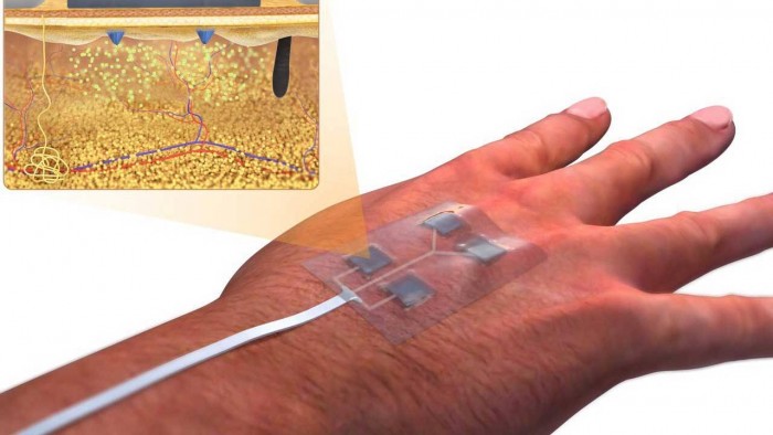 smart-bandage-1280x720.jpg