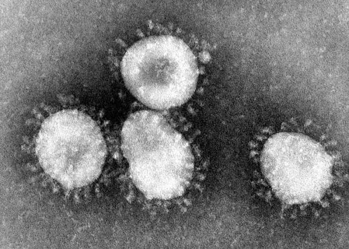 800px-Coronaviruses_004_lores.jpg