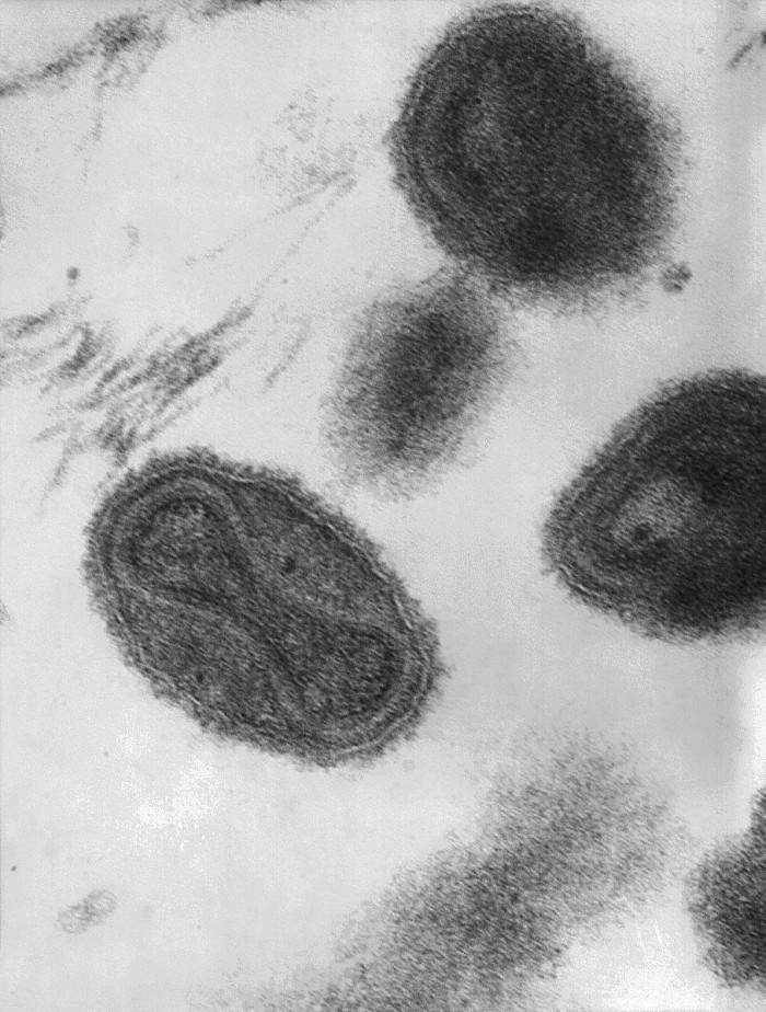 908px-Smallpox_virus_virions_TEM_PHIL_1849.JPG