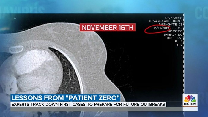 What France’s coronavirus experts have learned from their ‘p-5.mp4_20200517_091436.634.jpg