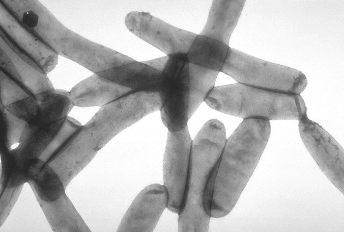 1920px-Legionella_pneumophila_01.jpg