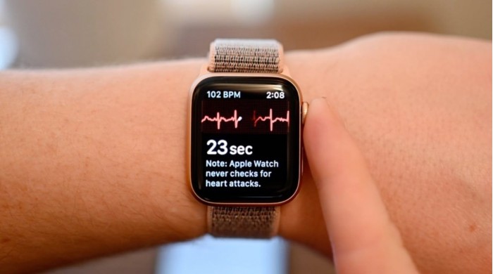 36855-68891-apple-watch-heart-ecg-xl.jpg