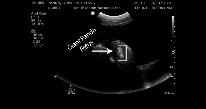 ultrasound-with-arrows.jpg