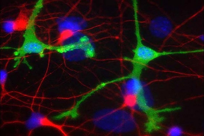 Dopaminergic-Neurons-and-Microglia.jpg