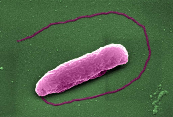 Superbug-Pseudomonas-aeruginosa.jpg