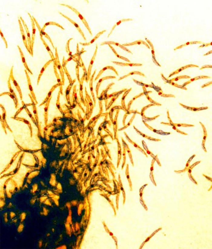 Malaria-Sporozoites.jpg