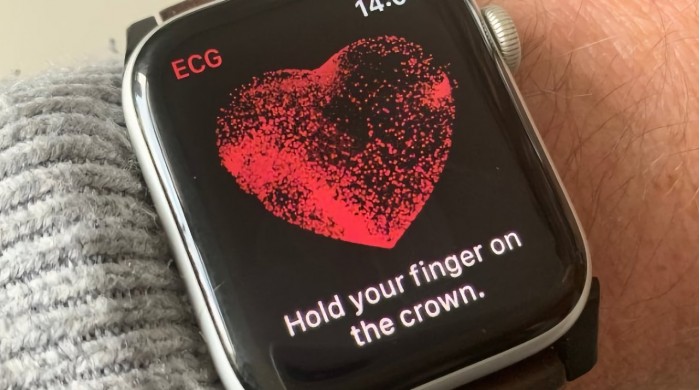 44880-87260-000-lead-Apple-Watch-health-xl.jpg