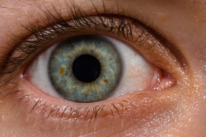 1599px-Human_eye_with_blood_vessels.jpg