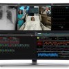GE Healthcare与微软合作推出帮助临床诊断COVID-19的新技术