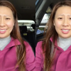 女子接受扁桃体手术后发现不会讲母语了：说话变成国外口音