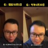 男子回应“不用洗发水变满头黑发” 拒绝外卖只吃蒸煮食物