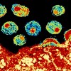“去势”HIV通过首次测试 可使体内病毒水平降至万分之一