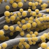 新研究：未来25年抗生素耐药性或致全球3900万人死亡
