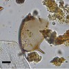 500年前马桶中发现的寄生虫揭示了全球中世纪疾病网络的证据