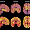 科学家发现神经性厌食症背后的关键大脑机制