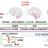 复旦团队发现帕金森全新治疗靶点 AI大显身手