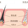 头发白了，还能变黑吗？医生的答案出乎意料