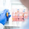 科学家开发出革命性的头颈癌血液检测方法