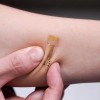 加州理工学院研发的智能绷带可提前几天检测感染