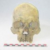 一具4000年前的骨骼揭示了美洲一种罕见的麻风病菌株 早于哥伦布到来之前
